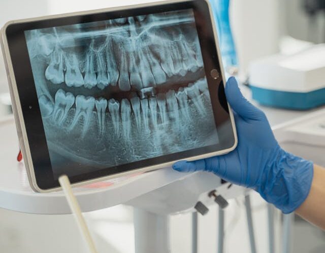 A person holding up an ipad with a picture of teeth.