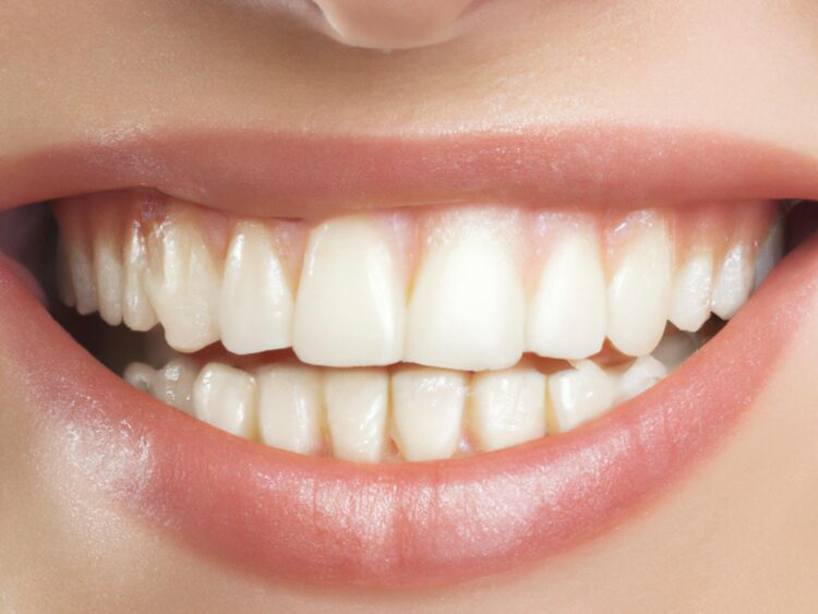 A close up of the teeth of a woman smiling